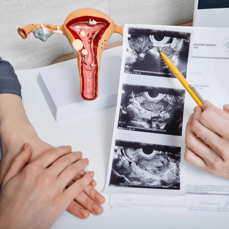Hysteroscopy
