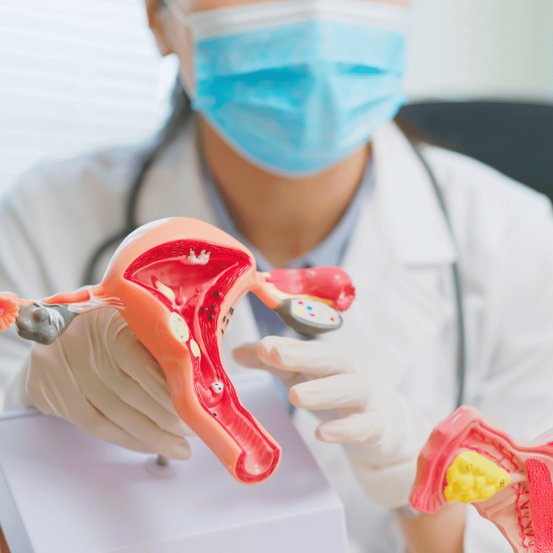 PCOS