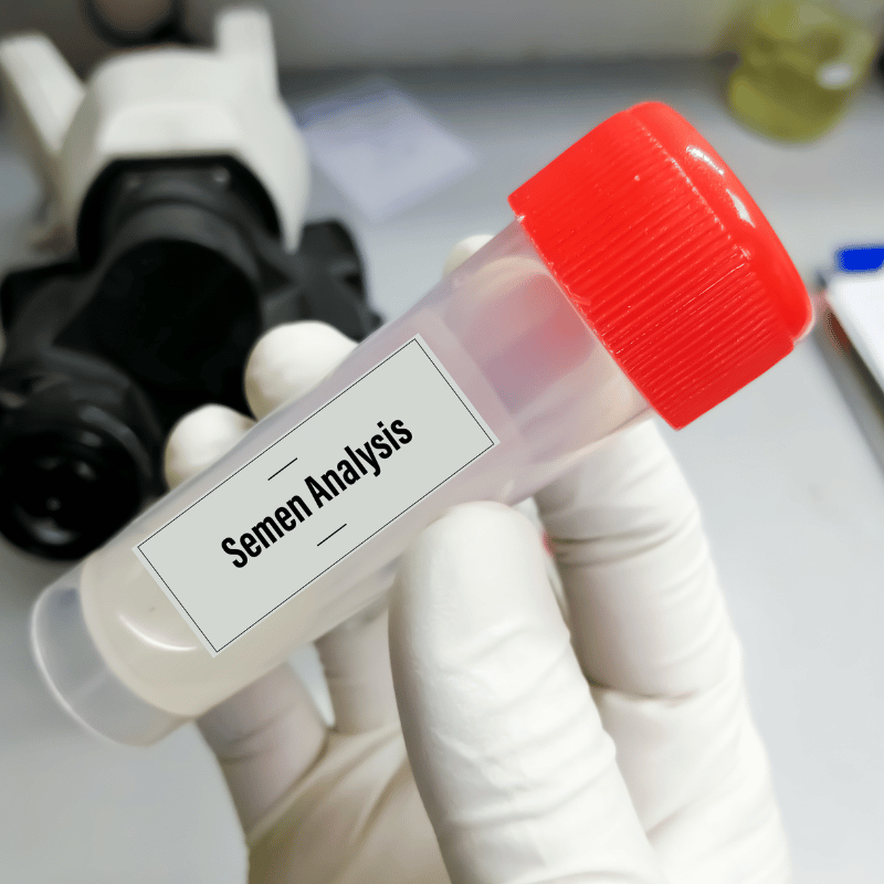 Semen Analysis