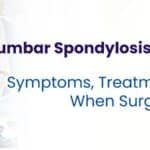 Lumbar Spondylosis Treatment in Solapur